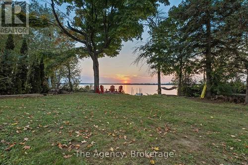 119 Campbell Beach Road, Kawartha Lakes (Carden), ON - Outdoor With View