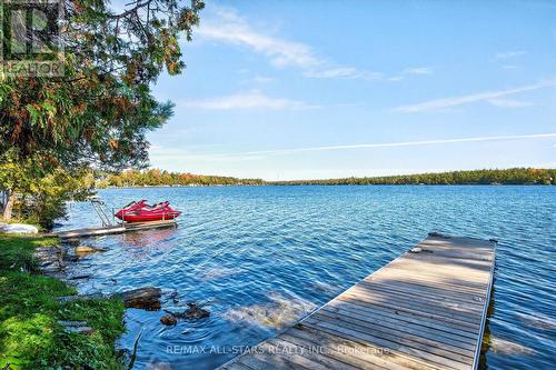 9 Lytle Lane, Kawartha Lakes (Bexley), ON - Outdoor With Body Of Water With View