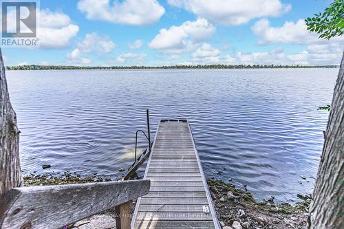 284 Lake Dalrymple Road, Kawartha Lakes, ON - Outdoor With Body Of Water With View