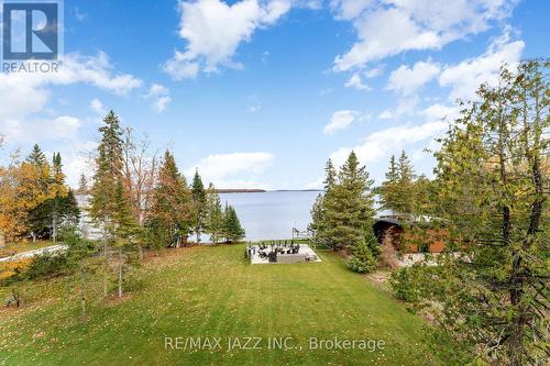 147 Elysian Fields Road, Kawartha Lakes (Fenelon), ON - Outdoor With View