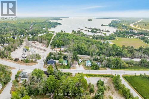 8304 County Road 169, Severn, ON - Outdoor With View
