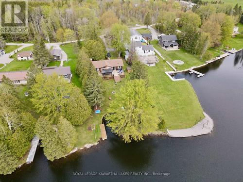 21 Trent View Road, Kawartha Lakes (Eldon), ON - Outdoor With Body Of Water With View