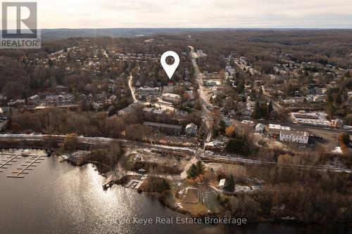 15 East Elliott Street, Huntsville (Chaffey), ON - Outdoor With View