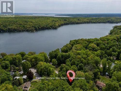 31 Lakeview Crescent, Tiny, ON - Outdoor With Body Of Water With View