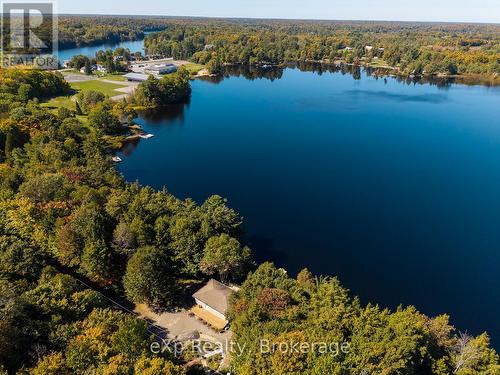 4 Fire Route 140 (Turtle Lane) Lane, Mckellar, ON - Outdoor With Body Of Water With View