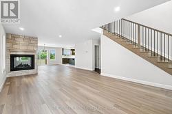 Upgraded Fireplace - 