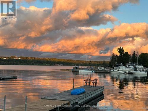 604 Champlain Road, Tiny, ON - Outdoor With Body Of Water With View