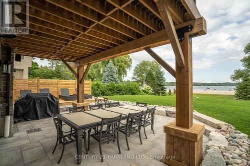 326 Tiny Beaches Road S, Tiny, ON - Outdoor With Deck Patio Veranda