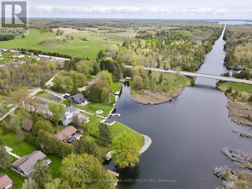 21 Trent View Road, Kawartha Lakes (Eldon), ON - Outdoor With Body Of Water With View