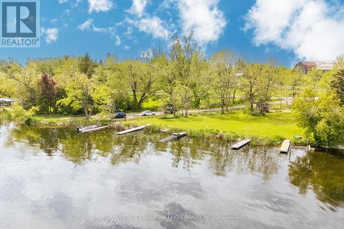 104 Cameron Drive, Kawartha Lakes (Fenelon), ON - Outdoor With Body Of Water With View