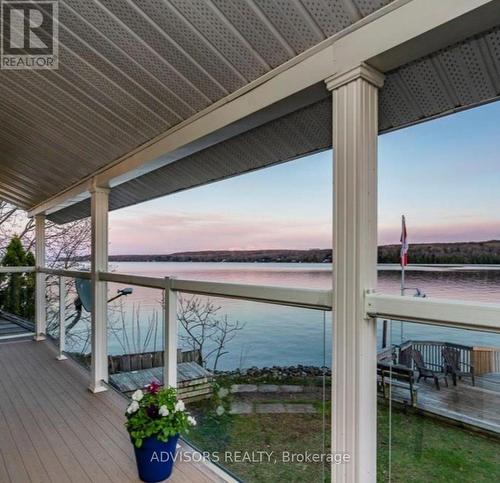 9 Bow Road, Tiny, ON - Outdoor With Body Of Water With Balcony With View With Exterior