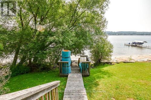379 Champlain Road, Penetanguishene, ON - Outdoor With Body Of Water