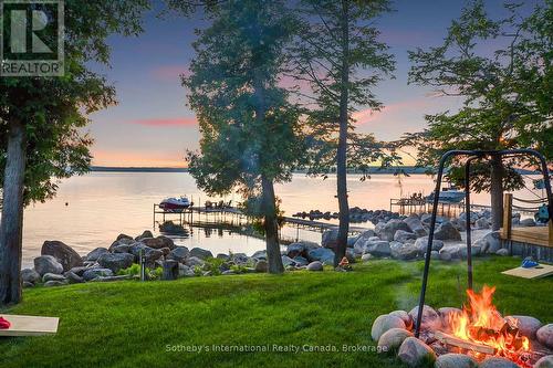 190 Melissa Lane, Tiny, ON - Outdoor With Body Of Water With View