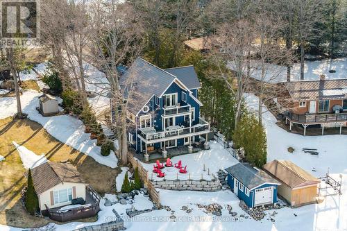 1749 Champlain Road, Tiny, ON - Outdoor