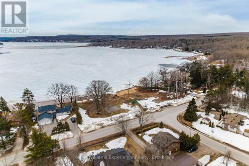 29 Nida Drive, Tiny, ON - Outdoor With Body Of Water With View