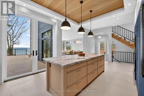160 Tiny Beaches Road N, Tiny, ON - 