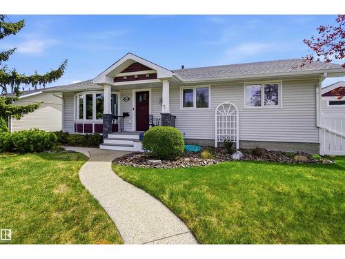 10663 59 St Nw, Edmonton, AB - Outdoor With Facade