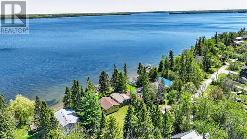 26 Lake Street, Kawartha Lakes (Bexley), ON - Outdoor With Body Of Water With View