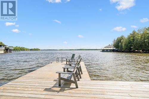 2 - 1032 Island Park Road, Muskoka Lakes (Medora), ON - Outdoor With Body Of Water With View