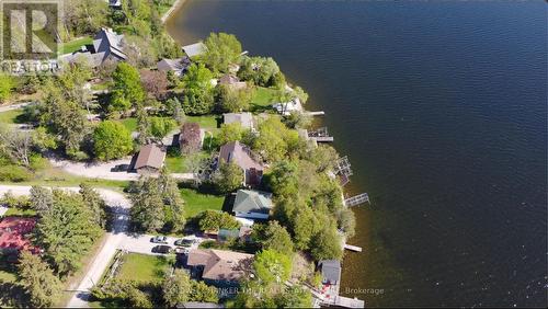 57 Island View Road, Kawartha Lakes, ON 
