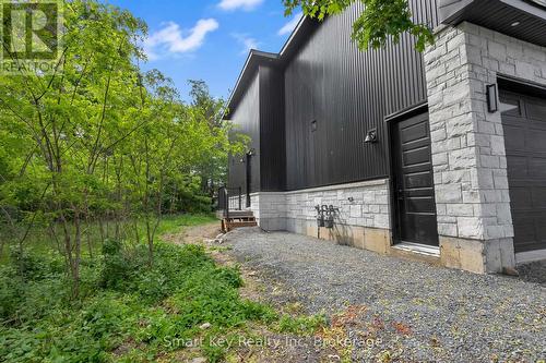 125 Brae Crescent, Ottawa, ON 