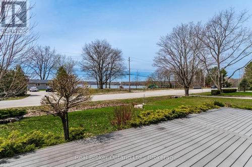 280 Peek-A-Boo Trail, Tiny, ON - Outdoor With View