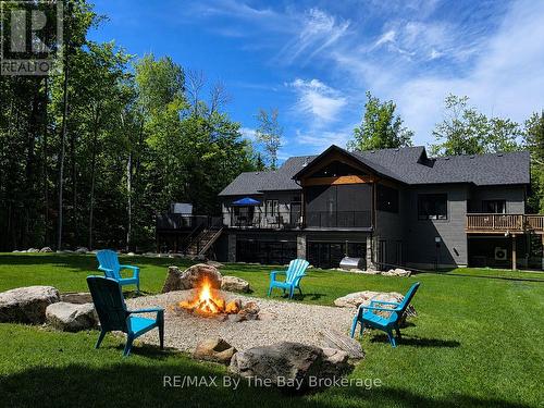 Fire Pit Area - 95 Spruce Street, Tiny, ON 