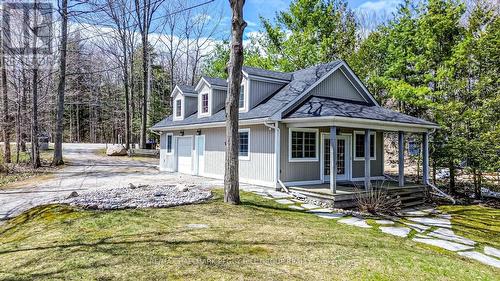 1449 Champlain Road, Tiny, ON - Outdoor
