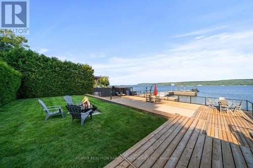 237 West Shore Drive, Tiny, ON 