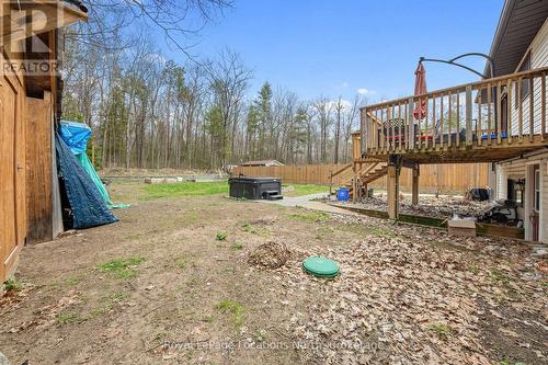 93 Ronald Avenue, Tiny, ON - Outdoor With Deck Patio Veranda