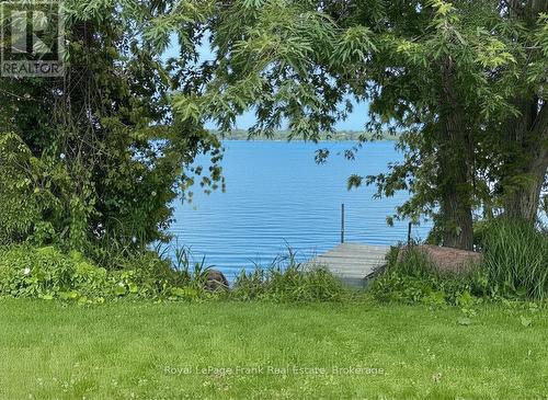 Lake Access - 3 Summit Drive, Scugog, ON 