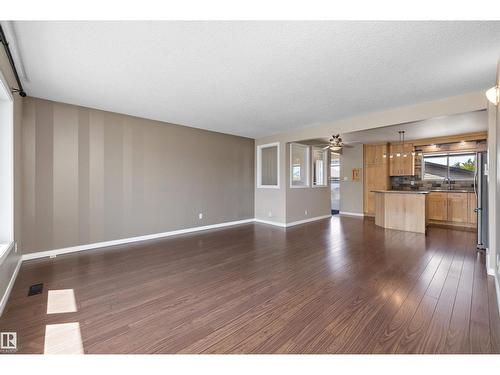 7540 152C Av Nw, Edmonton, AB 