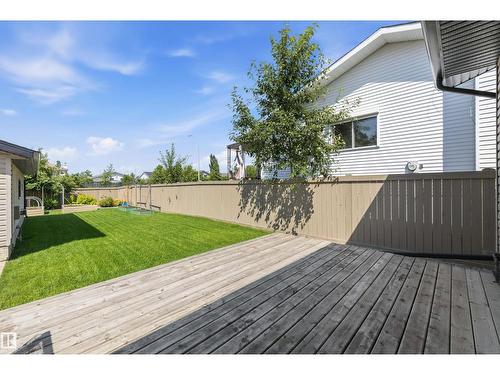 7540 152C Av Nw, Edmonton, AB 