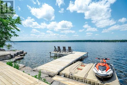 910 Birchview Road, Douro-Dummer, ON - Outdoor With Body Of Water With View