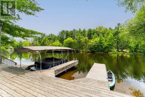 179 Santa'S Village Road, Bracebridge (Monck (Bracebridge)), ON - Outdoor With Body Of Water With Deck Patio Veranda