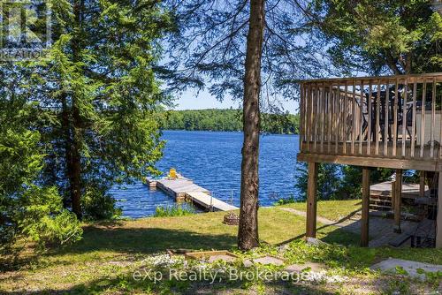 31 Loon Echo Trail, Seguin, ON - Outdoor With Body Of Water