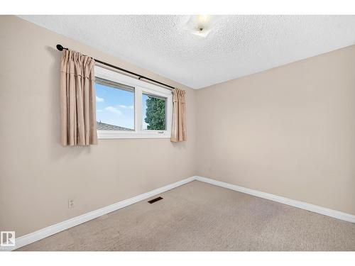 15020 88 St Nw, Edmonton, AB - Indoor Photo Showing Other Room