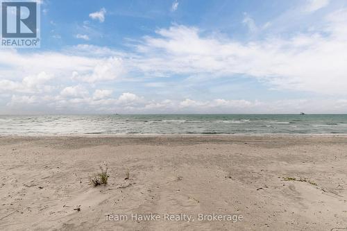 20 Scott Lane, Tiny, ON - Outdoor With Body Of Water With View