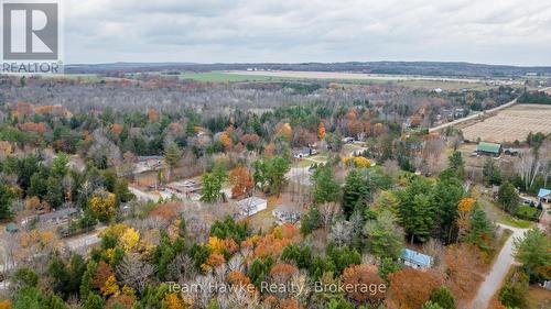 20 Scott Lane, Tiny, ON - Outdoor With View