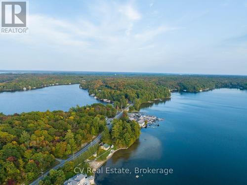 1356 & 1357 Peninsula Road, Muskoka Lakes (Medora), ON 
