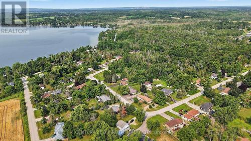 25 Glengrove Avenue, Oro-Medonte, ON 