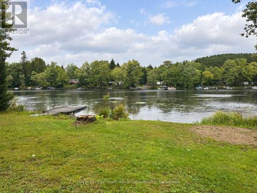 25 Cole Point Trail, Mckellar, ON 