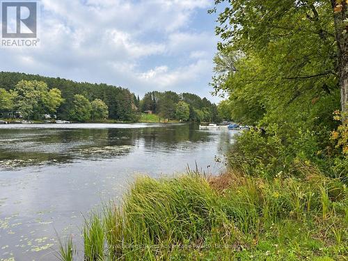 25 Cole Point Trail, Mckellar, ON 