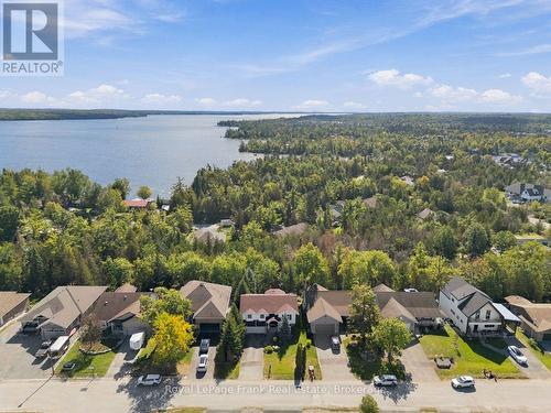 62 Cedartree Lane, Kawartha Lakes (Bobcaygeon), ON 