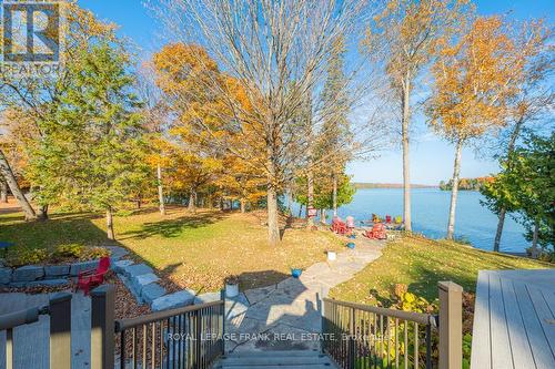 1187 Lakehurst Road, Trent Lakes, ON 