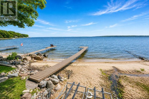 1515 Champlain Road, Tiny, ON 