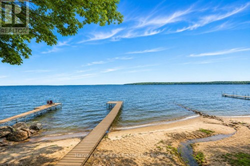 1515 Champlain Road, Tiny, ON 