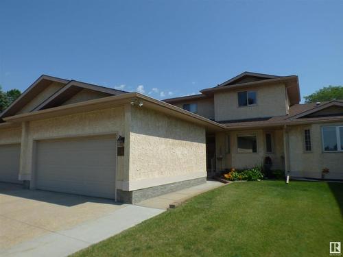 147 Knottwood Rd N Nw, Edmonton, AB 