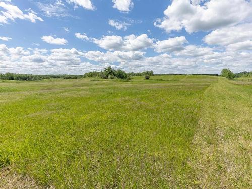 19303 Twp Rd 515A, Rural Beaver County, AB 