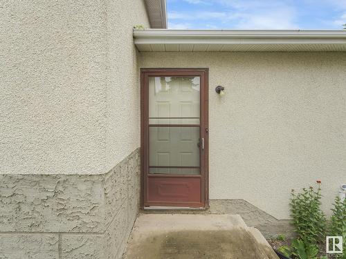 17104 96 St Nw, Edmonton, AB 